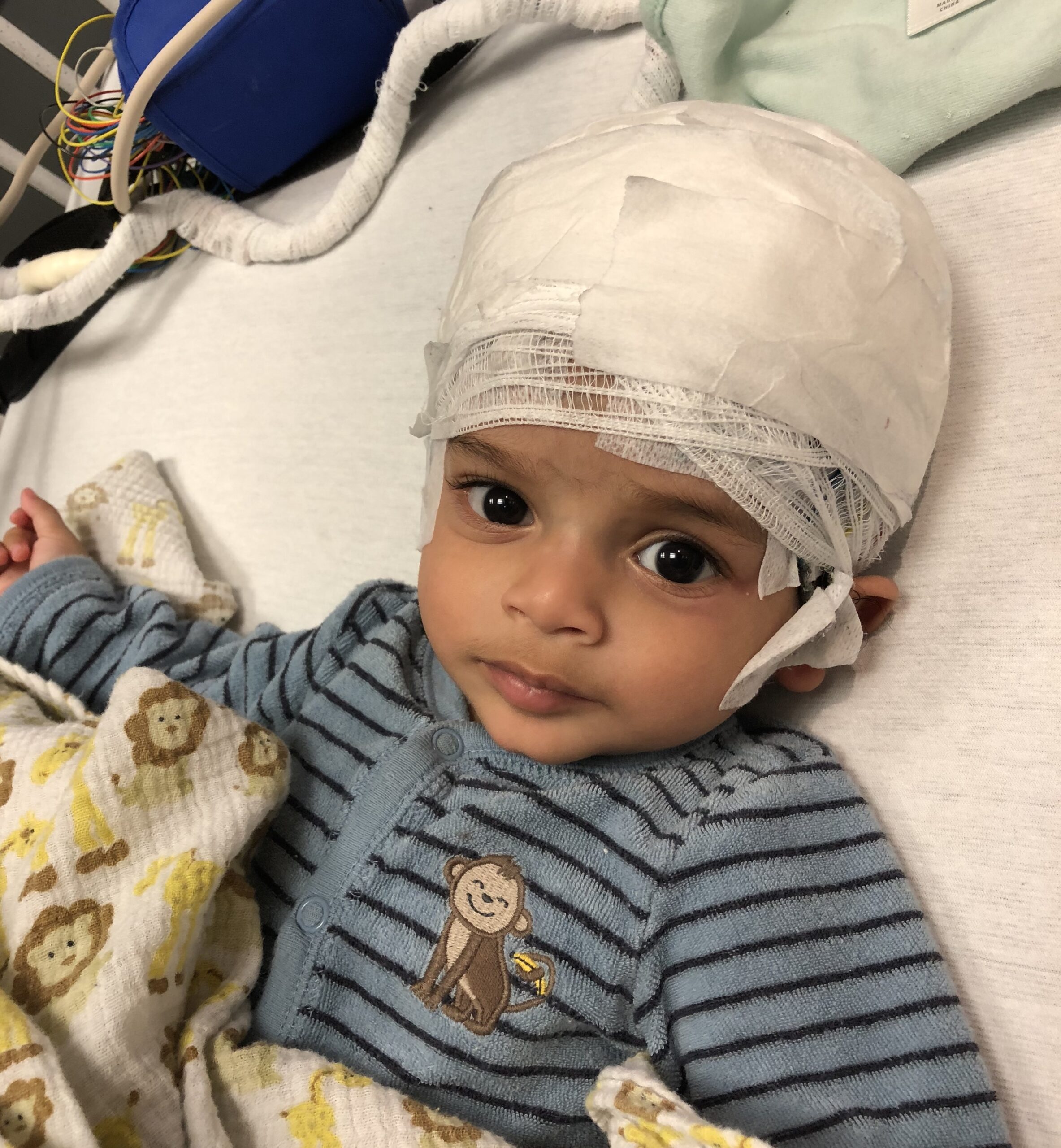 Ishaan is pictured undergoing an EEG following his first bout with seizures